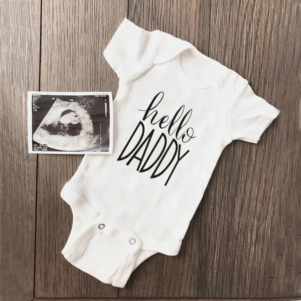 Baby Clothing Online - Zomer Pasgeboren Baby Baby Jongen Meisje